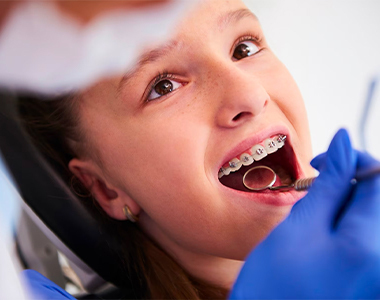 Types pf Braces